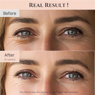 Beauty of Joseon Revive Eye Serum : Ginseng + Retinal 30ml