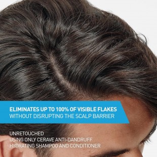 CeraVe Hydrating Anti Dandruff Shampoo, 1% Pyrithione Zinc Dandruff Treatment With Ceramides, Niacinamide & Hyaluronic Acid 355mL