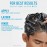 CeraVe Hydrating Anti Dandruff Shampoo, 1% Pyrithione Zinc Dandruff Treatment With Ceramides, Niacinamide & Hyaluronic Acid 355mL