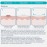 CeraVe Hydrocolloid Blemish Patches, Oil Absorbing Spot Control with Ceramides and Niacinamide 22Count