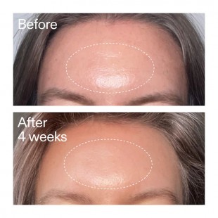 The INKEY List Advanced Retinal Serum for Fine lines + Wrinkles