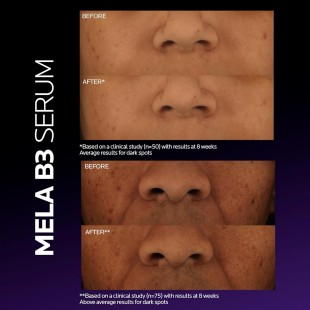 La Roche-Posay Mela B3 Face Serum