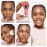 L'Oréal Revitalift 5% Pure Glycolic Acid Peeling Toner with Aloe Vera, Alcohol Free, Fragrance Free 6 fl oz