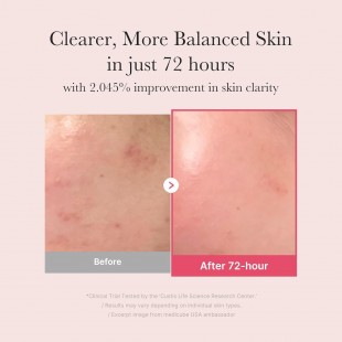 MEDICUBE TXA+Niacinamide 15% Glow Facial Serum for After Spot Care 30mL