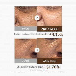 MEDICUBE Deep Vitamin C Capsule Serum 30mL