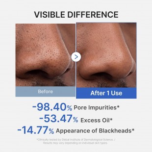 MEDICUBE Zero Pore Blackhead Mud Mask - Pore Cleansing & Gentle Exfoliating 100gr