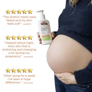 Palmer's Massage Lotion for Stretch Marks and Pregnancy Cocoa Butter Formula 
