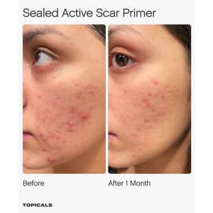 TOPICALS Sealed Active Scar Primer