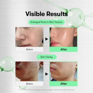 VT COSMETICS CICA Reedle Shot 700 Serum 30mL